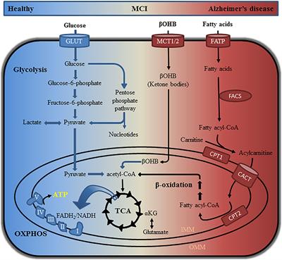 Application of Metabolomics in Alzheimer’s Disease